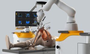 The Revolution of Robotic Knee Replacement Surgery