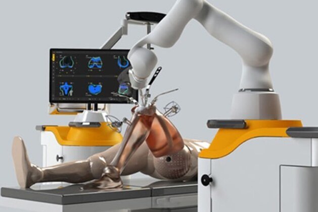 The Revolution of Robotic Knee Replacement Surgery